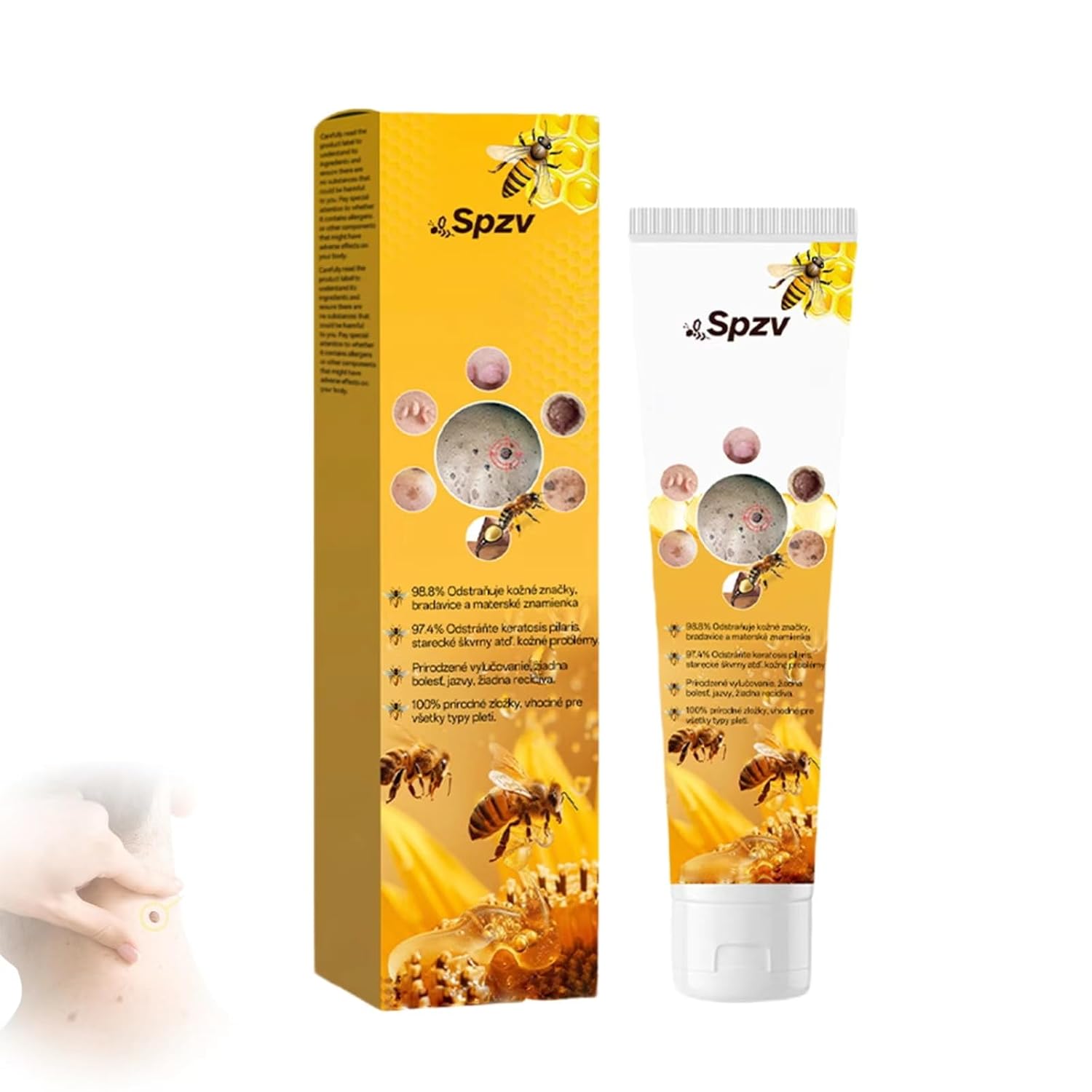 Bee Venom Treatment Cream, 2025 New Bee Venom Spot removal Cream for All Skin Types 1PC