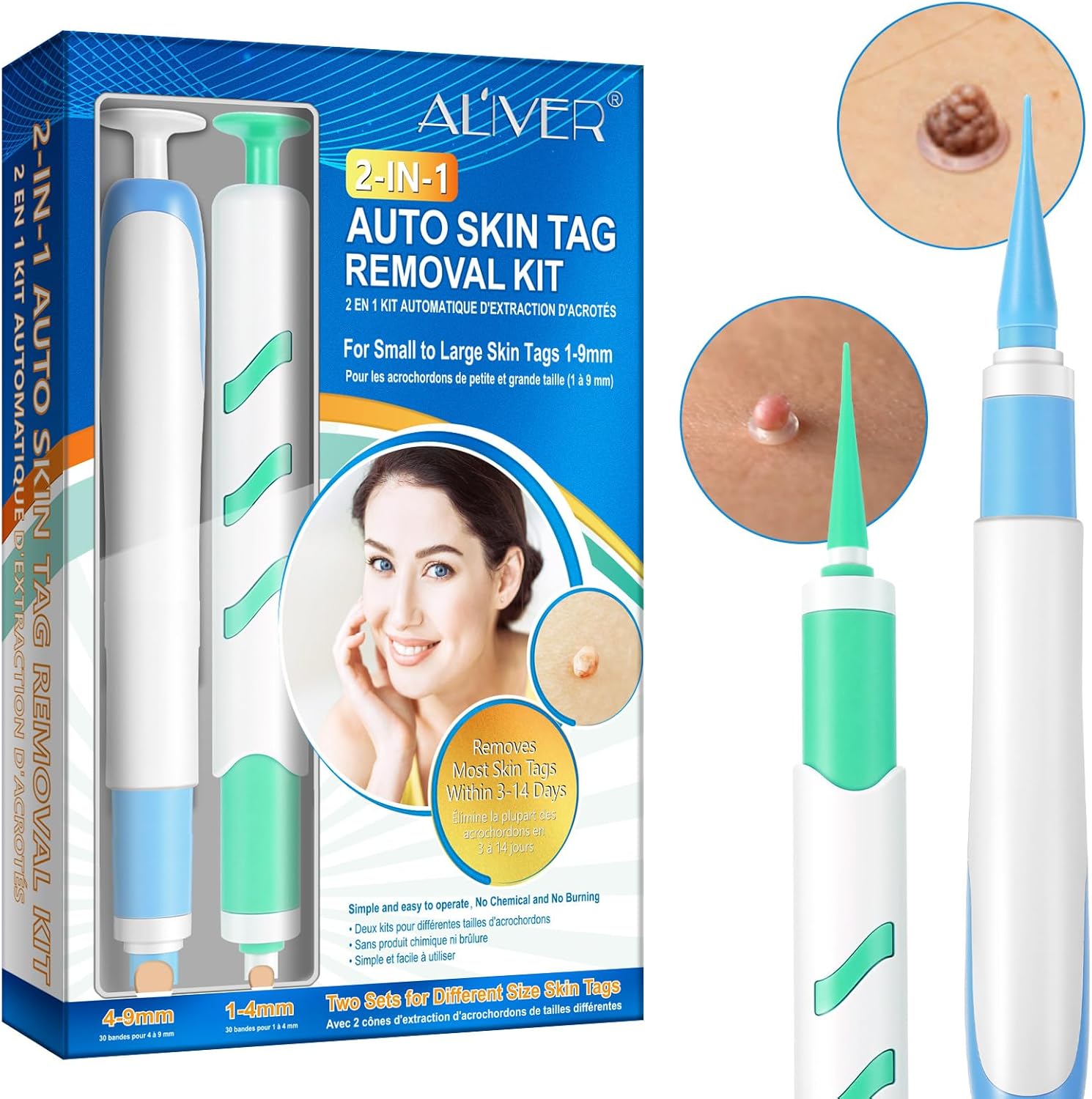 Uocasi Remover Device Blue-2